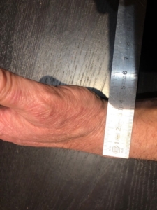 Mesure de l’épaisseur du poignet avec une règle métallique rigide