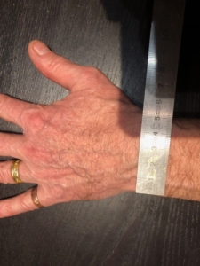 Mesure de la largeur du poignet avec un réglet métallique rigide